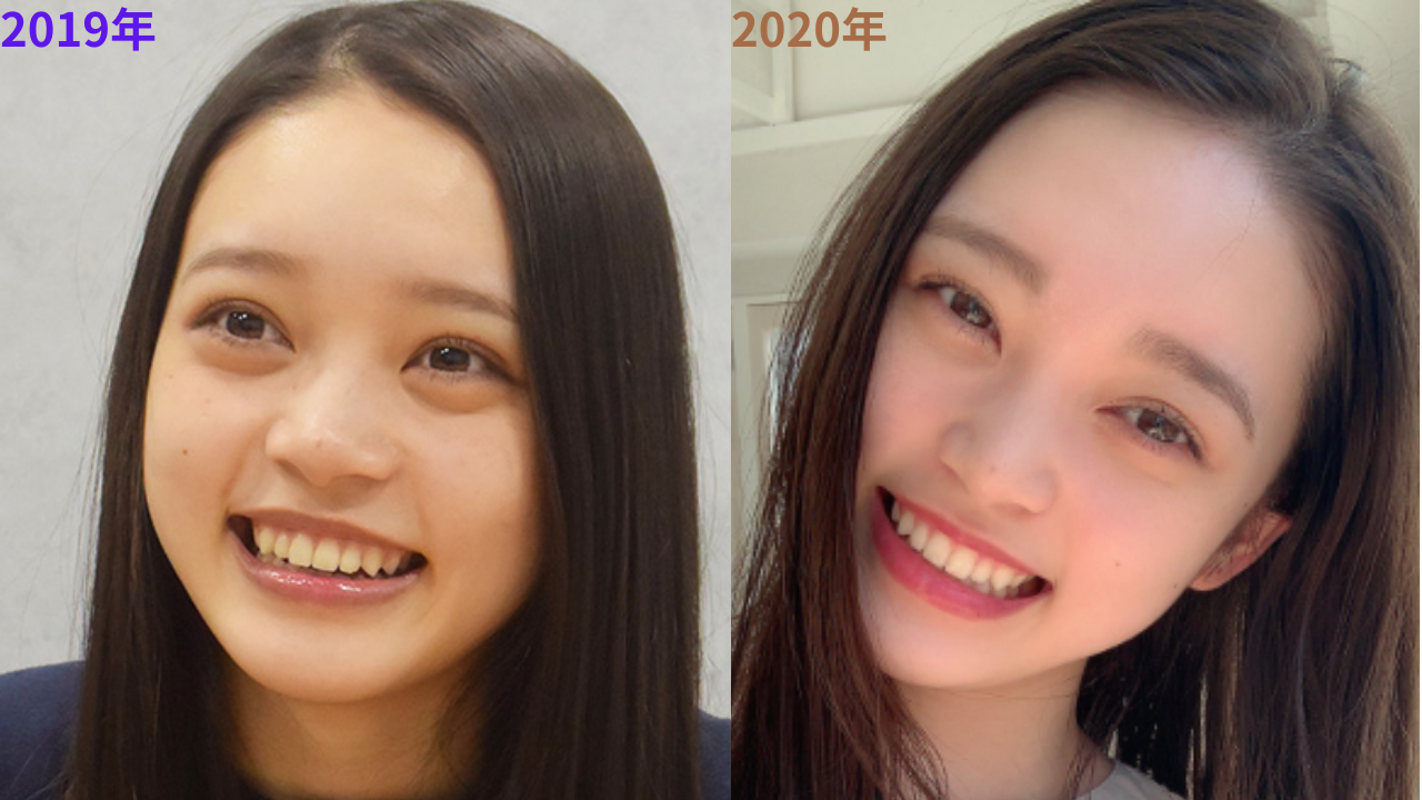 髙石あかり　髙石あかり　整形　整形疑惑　顔変わった　目　クマ　涙袋　二重　口元　鼻筋　鼻　頬　小顔　顎　輪郭　フェイスライン　かわいい　キュート　色気　大人　画像比較　メイク　照明　光　脂肪　矯正　ばけばけ　NHK　連続テレビ小説　ヒロイン　松野トキ